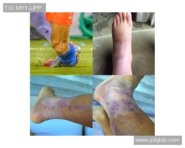 足球球星们常见的伤病类型与恢复过程解析